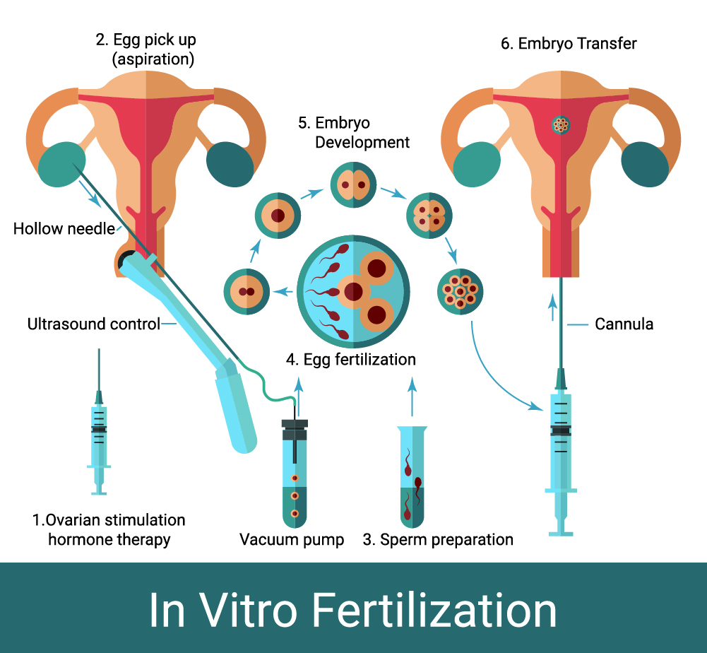 IVF centers