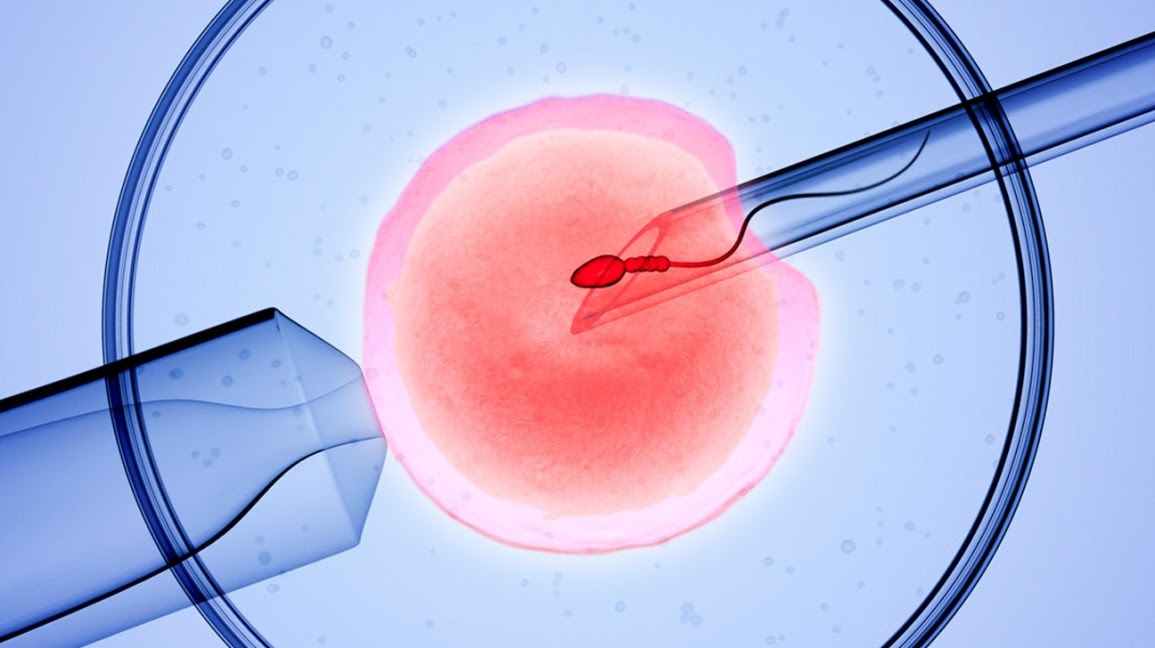 infertility treatment in Lucknow